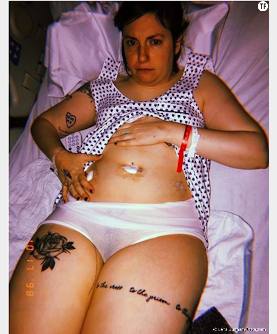 Après l'ablation de son ovaire gauche, Lena Dunham publie une photo d'elle sur son compte Instagram