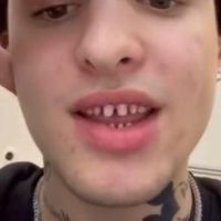 Ce dentiste alerte contre la tendance des "dents limées" sur TikTok