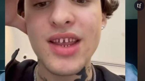 Ce dentiste alerte contre la tendance des "dents limées" sur TikTok