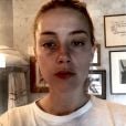  Le visage tuméfié d'Amber Heard, photo du procès de Fairfax diffusée le 5 mai 2022 