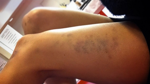 Shy'm : un accident pendant sa tournée