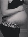 #LoveYourLines : les femmes affichent leurs corps transformés par la grossesse