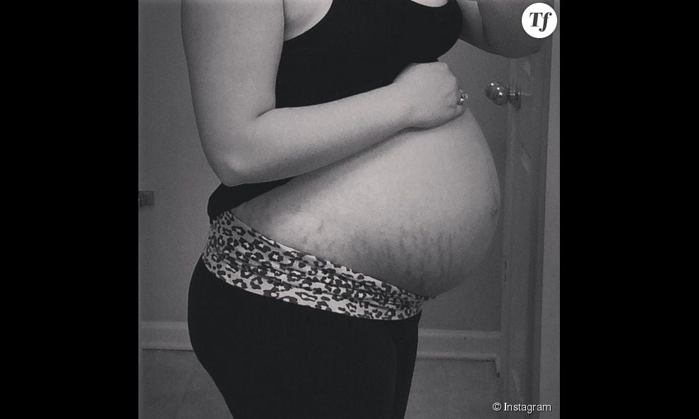 #LoveYourLines : les femmes affichent leurs corps transformés par la grossesse