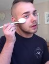 Jake Ward n'a pas hésité à dévoiler ses propres techniques pour camoufler son acné persistante, il en faut du courage!