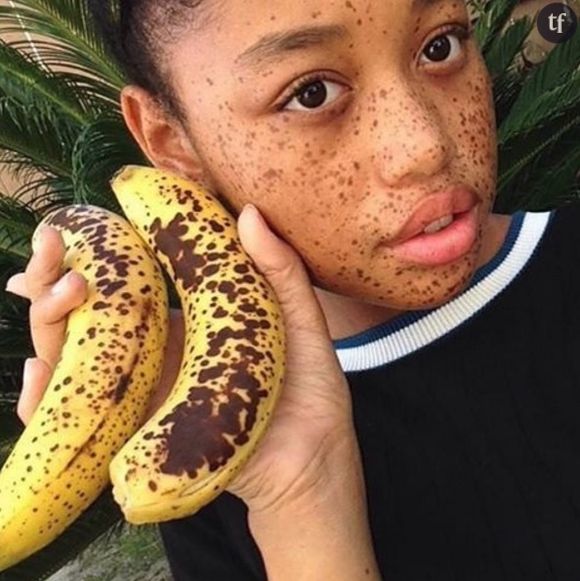 Salem Mitchell : la jeune femme comparée à une banane devenue mannequin