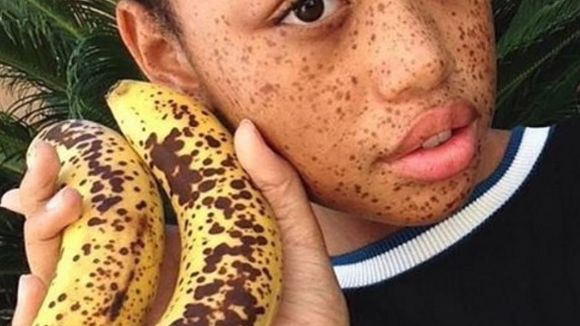 Comparée à une peau de banane, elle signe un contrat de mannequin