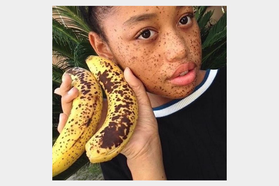 Salem Mitchell : la jeune femme comparée à une banane devenue mannequin