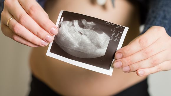 PMA, congélation des ovocytes... Willy Pasini décrypte les nouveaux moyens de faire un bébé