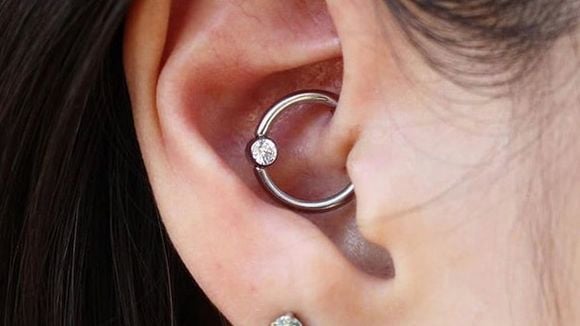 Ce piercing d'oreille serait-il la solution miracle aux migraines ?