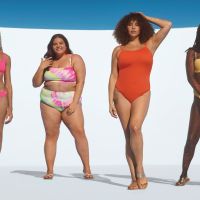 Une mannequin atteinte d'ichtyose pose en bikini pour la nouvelle campagne Target