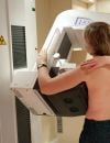 Mammographie réalisée sur une patiente