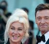"Trahison", “Une blessure profonde” : Hugh Jackman infidèle ? Son ex femme Deborra-Lee Furness dévoile tout en interview