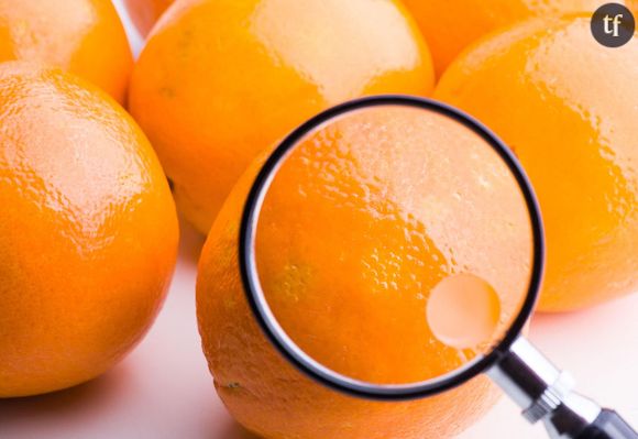 La cellulite, aussi appelée “peau d’orange”, est une modification de la structure du tissu adipeux sous-cutané qui touche près de 90% des femmes. Elle se caractérise par un aspect irrégulier et capitonné de la peau, particulièrement visible sur les cuisses, les hanches et les fesses. Cependant, bien qu’il s’agisse d’une caractéristique naturelle qui peut apparaître chez tout le monde, elle est diabolisée depuis des années.