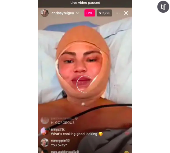Chrissy Teigen fait le buzz sur Instagram