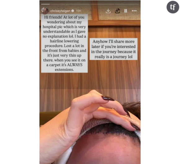 Chrissy Teigen fait le buzz sur Instagram